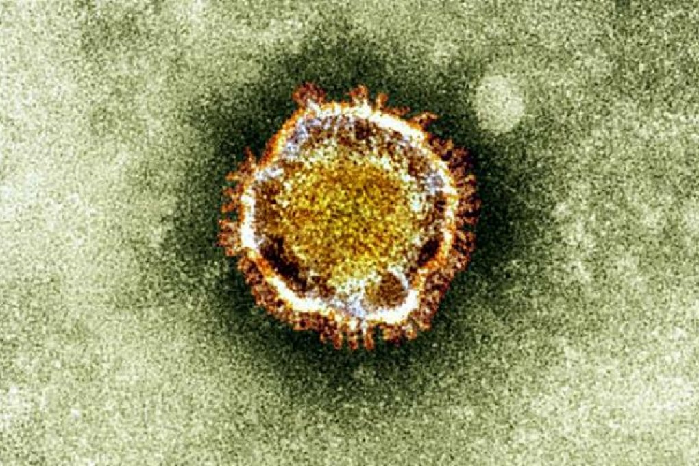 A British Health Protection Agency image of a coronavirus, part of a family of viruses that cause Sars, first identified last year in the Middle East. Photo: AP