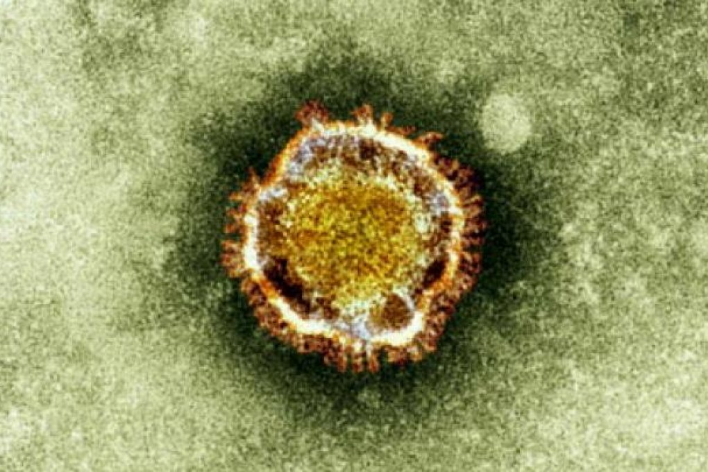 An electron microscope image of a coronavirus, part of a family of viruses that cause ailments including the common cold and SARS. Photo: AP