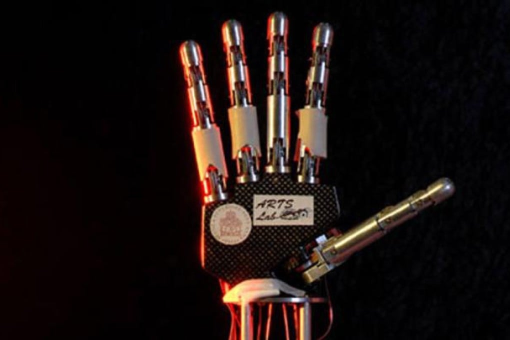 A prosthetic hand that can control grasp. Photo: Guardian