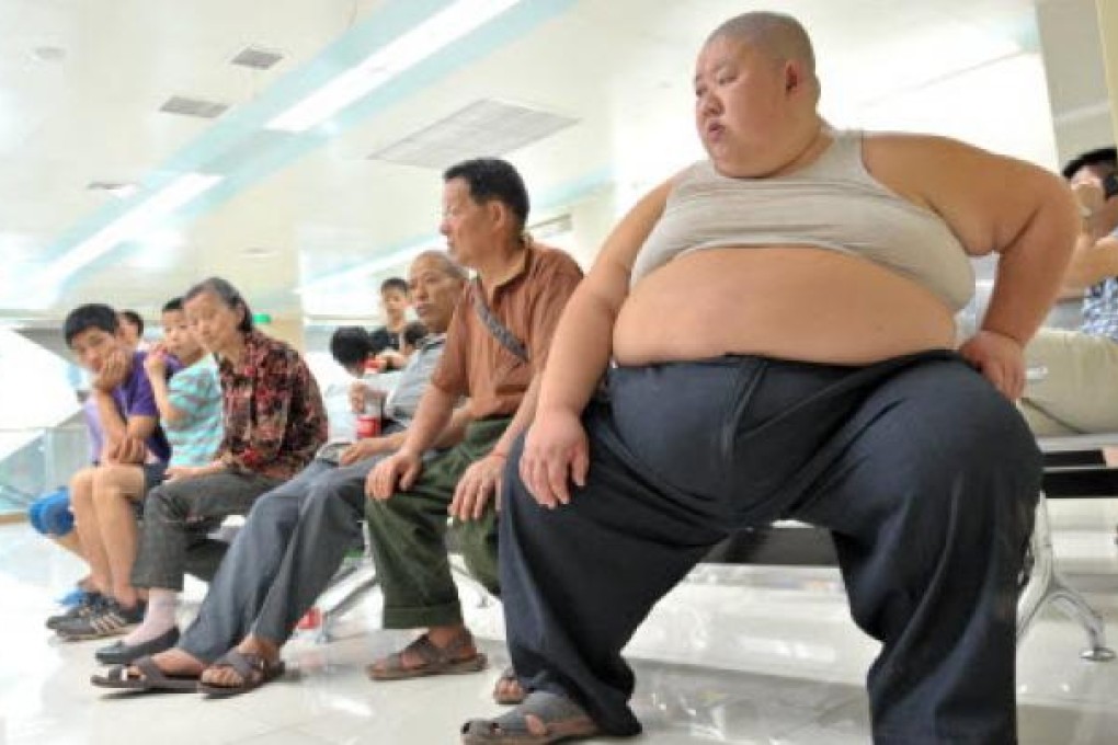 An obese man in China. Weight loss surgery may not be cost-effective for all obese people, a new study says. Photo: Xinhua.