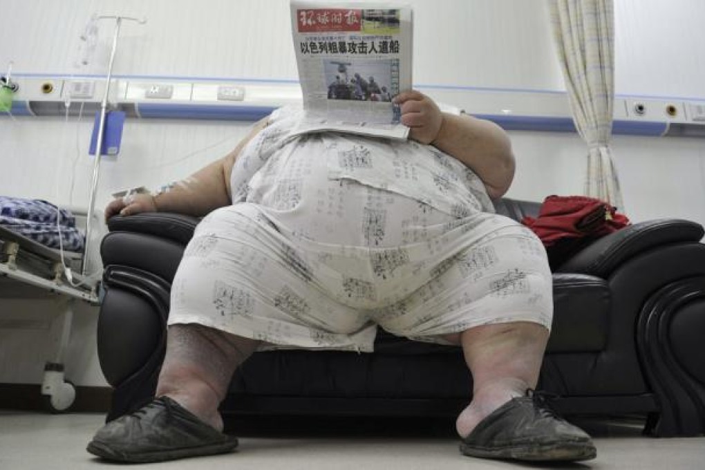 Sorting obesity myths from fact. Photo: Reuters