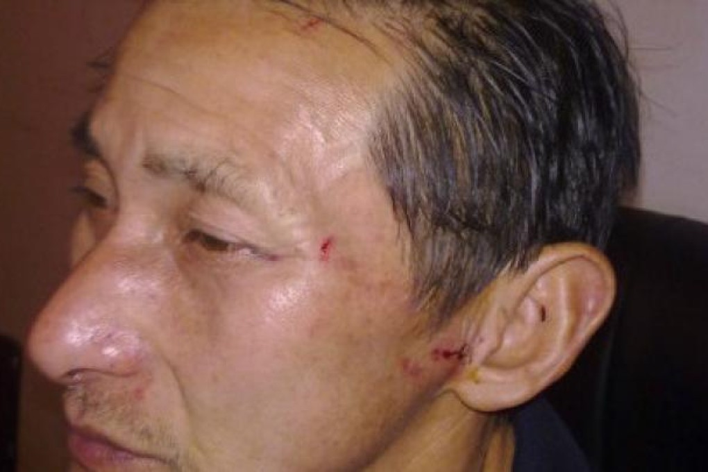 Online photo shows scratches and bruises on Chen Yuqian's face. Photo: SCMP Pictures