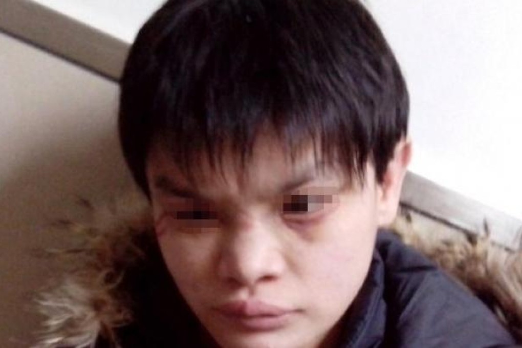 Photo of the girl Yun posted online. He claimed she was assaulted by welfare institute's staff. Photo: SCMP Pictures