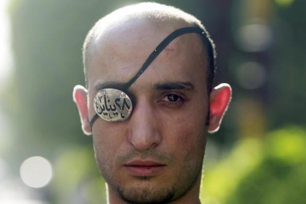 A blinded victim