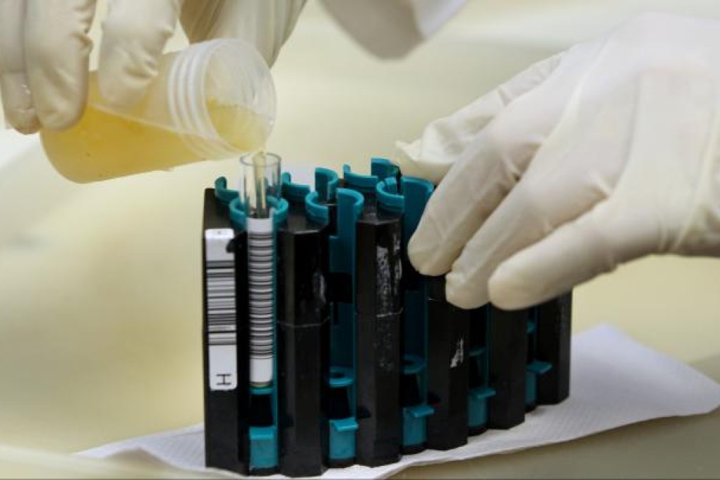 Rehabilitation authorities are stepping up surprise urine checks on discharged drug offenders to tighten scrutiny of potential relapses. Photo: Nora Tam