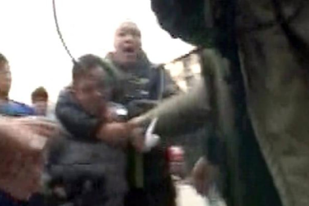 TVB camera man injured by policemen near Liu Xia's home in Beijing. Photo: Now TV