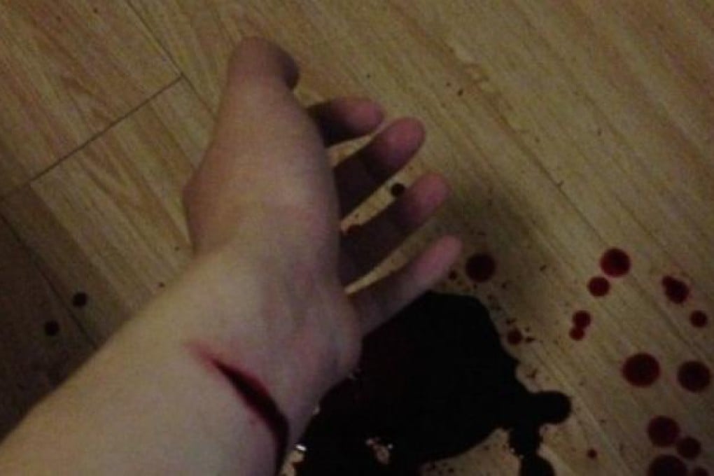 The photo posted by the suicidal man alerted netizens who called the police.