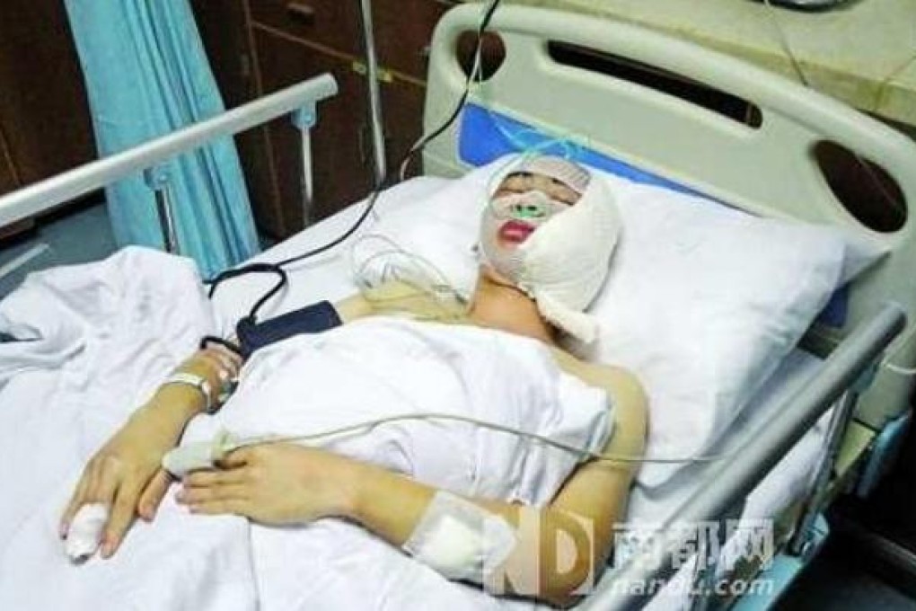 Photo from nandu.com, of the injured chengguan official in hospital.