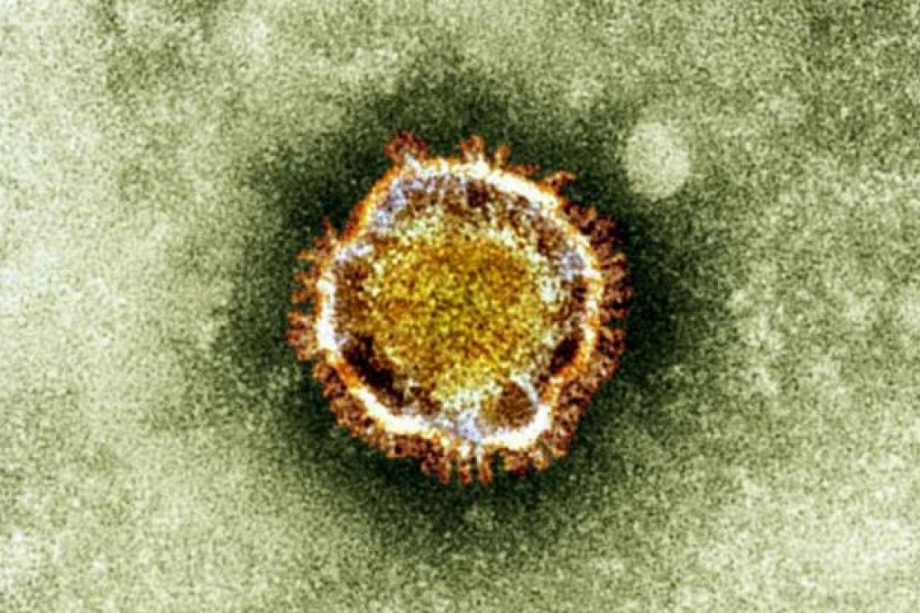 An electron microscope image of a coronavirus, part of a family of viruses that cause ailments including the common cold and Sars. Photo: AP
