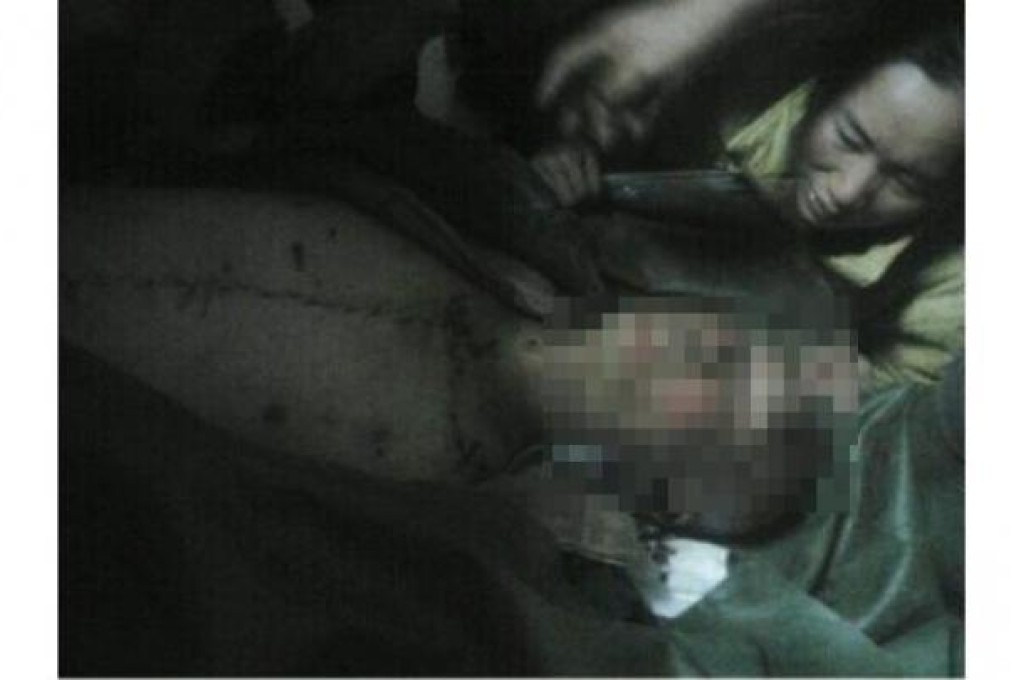 Online photo shows dead farmer Song Wuhua.