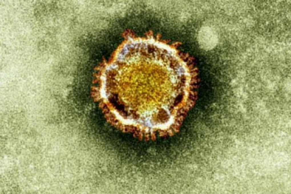 A microscopic image of the coronavirus which can cause Sars and other ailments. Photo: AP