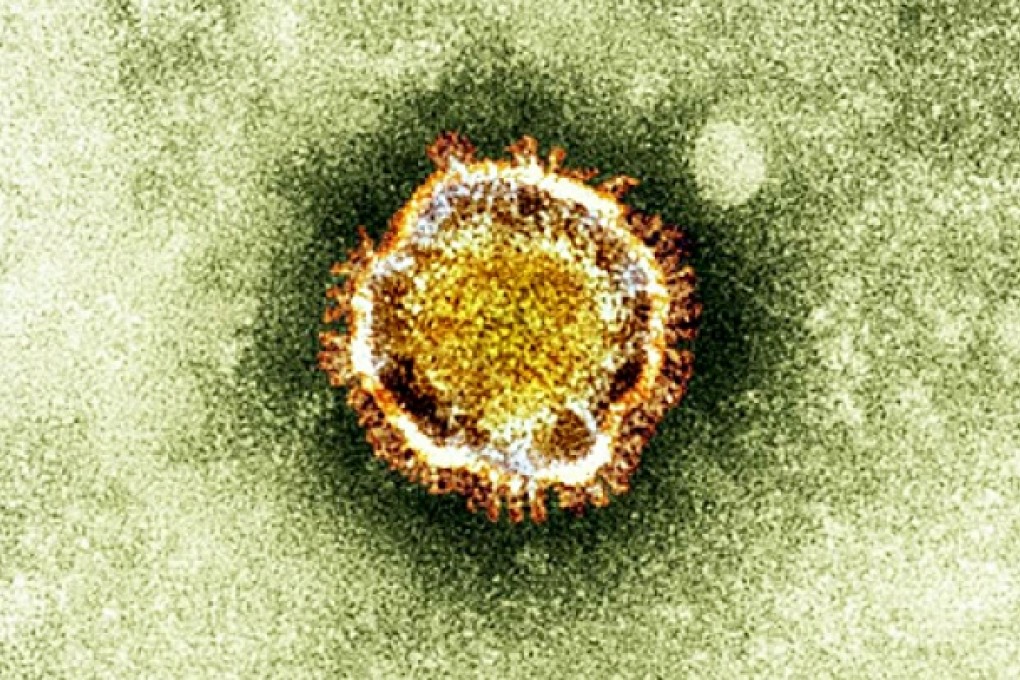 The novel coronavirus or hCoV-EMC was first detected last year and is a cousin of severe acute respiratory syndrome. Photo: AP