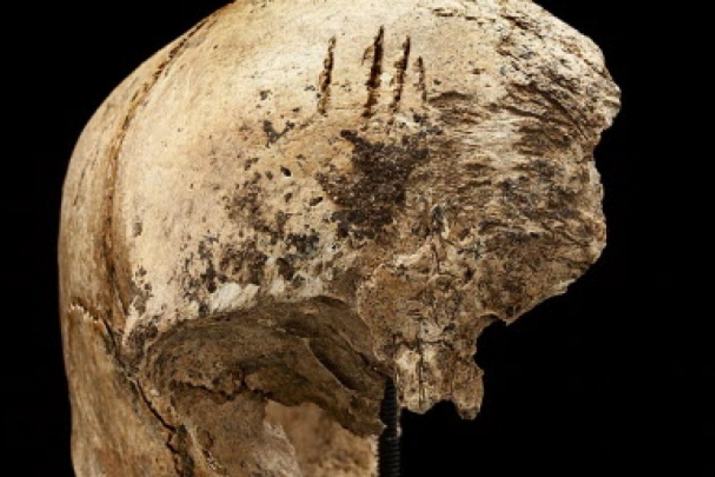 Four shallow chops to an incomplete skull excavated in James Fort, Jamestown, Virginia at the Jamestown Rediscovery Project. Photo: Reuters