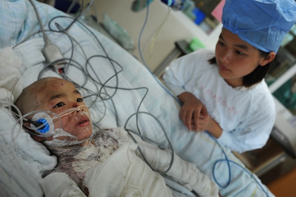 A nurse takes care of seven-year-old Lin Qiurong who was a child-abuse victim at a hospital in Guangzhou. Lin will need five to seven skin graft operations after her father poured boiling water on her. Photo: Imaginechina