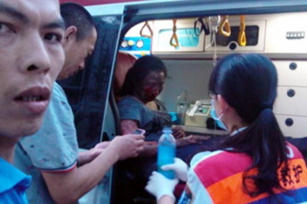 A passenger with a blackened face and arms receives treatment. Photo: SCMP