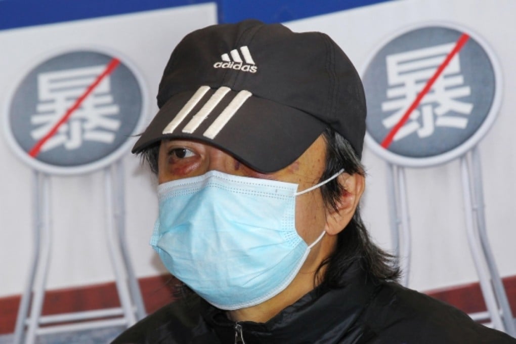 Chan at the media conference in which he showed the injuries he received from the attack in Mong Kok last week. Photo: Dickson Lee