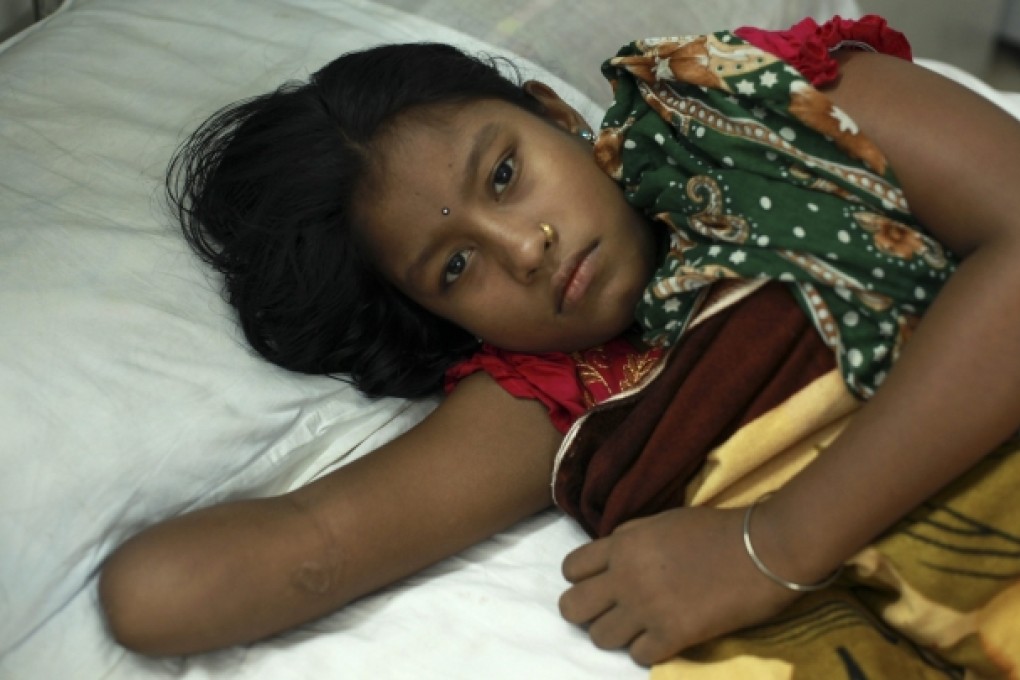 A woman, who lost her arm in the Rana Plaza building collapse, undergoes treatment at a Bangladesh hospital. The April 24 building collapse caused 1,130 deaths. Photo: EPA