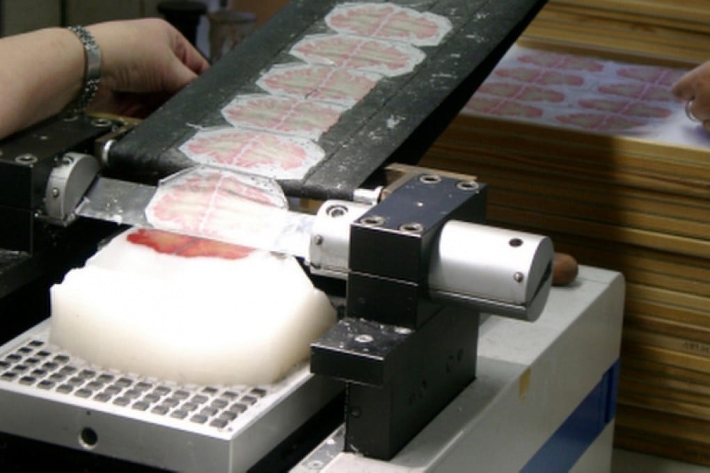 A microtome is used to cut the brain of a 65-year-old woman into slices for scanning and digital reconstruction.