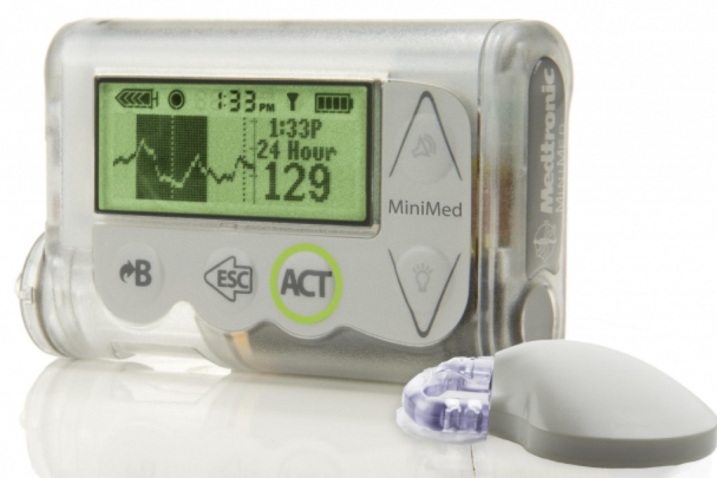 The Medtronic pump that dispenses insulin. Photo: AP