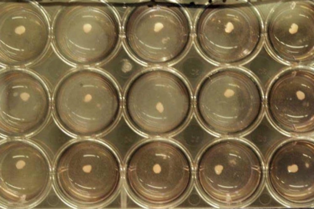 Human liver cells were grown in petri dishes. Photo: NYT