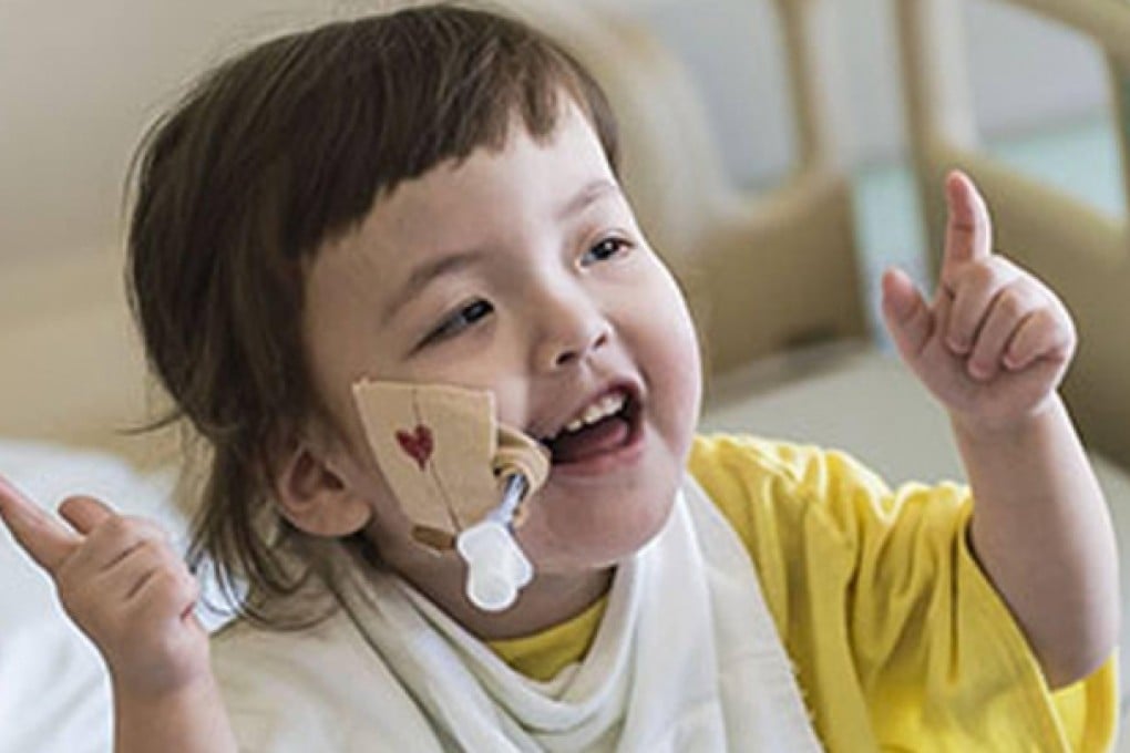 Hannah Warren was born with no windpipe. Photo: Jim Carlson