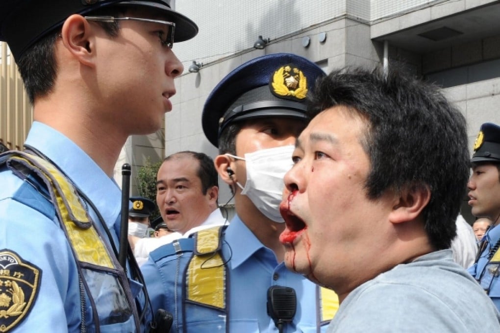 A Korean victim of a nationalist group protest. Photo: AFP