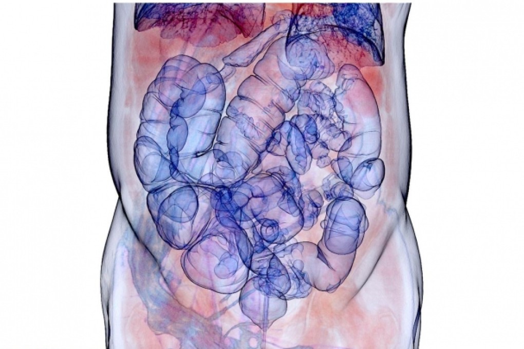 Regular cancer screenings help to halt the disease. Photo: Corbis