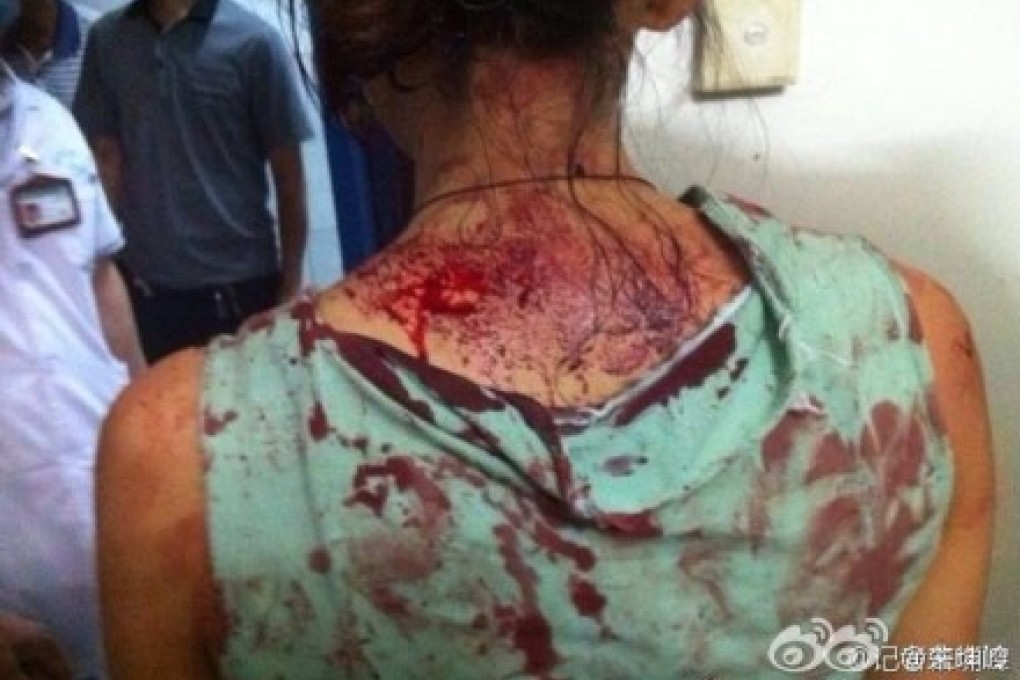 A demonstrator beaten up by riot police in Linwu, Hunan, on Thursday. Photo: Screenshot from Sina Weibo