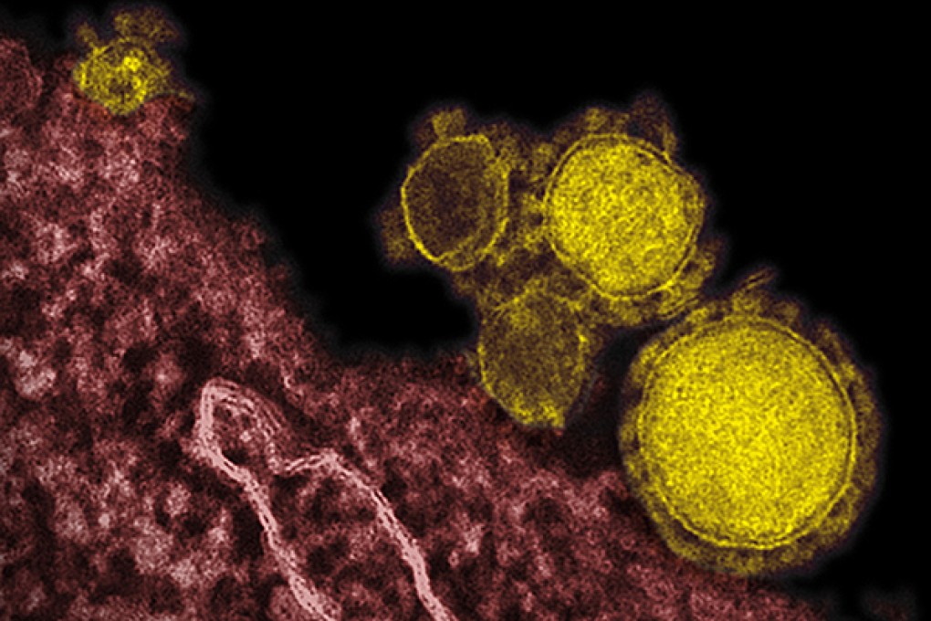 wo newly discovered viruses are twice as large as the previous record-holders
