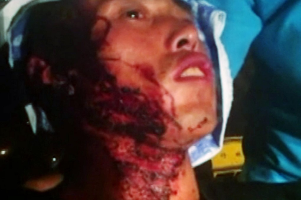 A vendor in Harbin allegedly beaten up by urban enforcers, causing more anger online against thuggery. Photo: SCMP