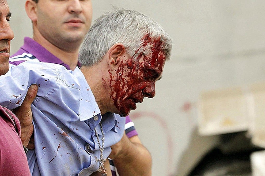 Francisco Jose Garzon Amo after the train derailment. Photo: EPA