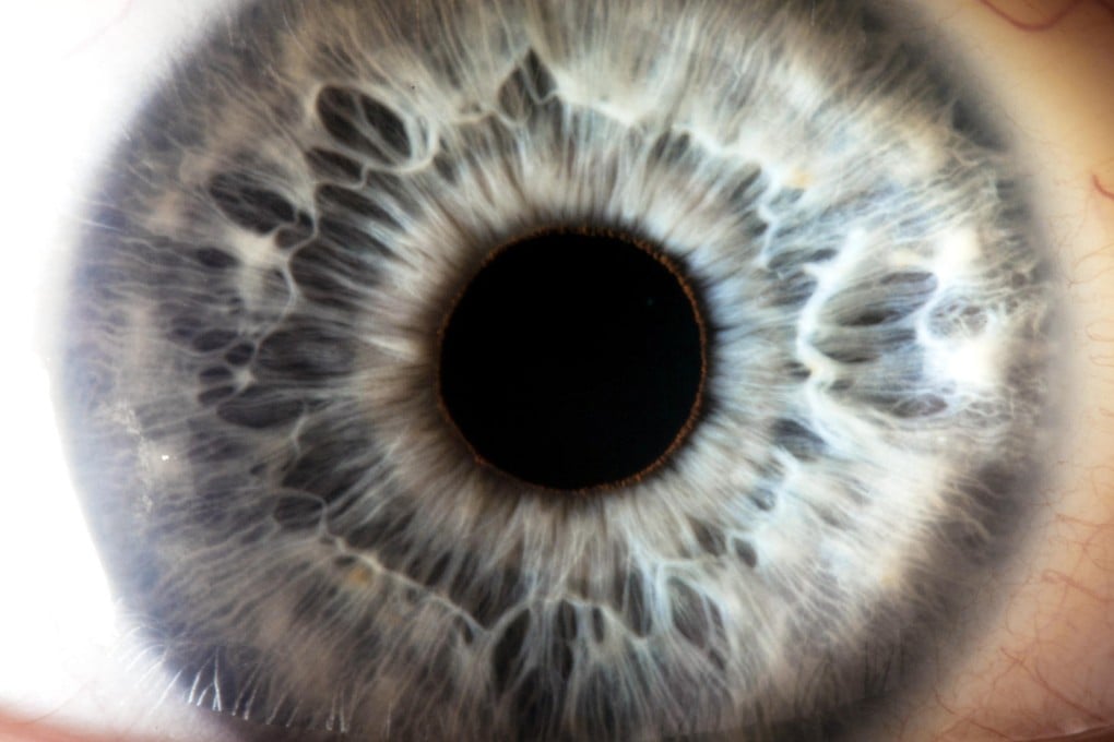 Locked-in patients who cannot move their eyes, can communicate using their pupils