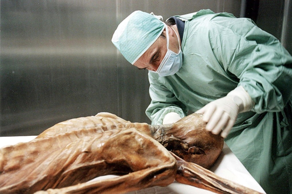 A Bronze Age mummy known as Oetzi. Photo: AFP
