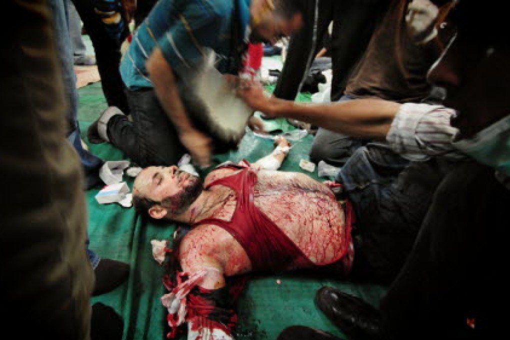A wounded protester receives treatment inside Al-Fath mosque in Ramsis Square where protesters are participating in a rally in downtown Cairo. Photo: Xinhua