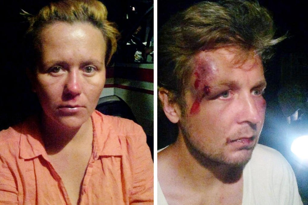 Viktor Svyatskiy and Anna Hutsol after they were beaten. Photo: AFP