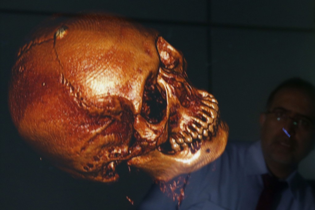 A Malaysian entrepreneur believes so-called digital autopsies could largely displace the centuries-old traditional knife-bound one. Phoot: Reuters