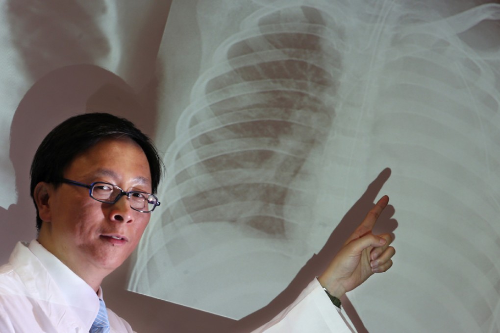 Dr Ho Pak-leung. Photo: Felix Wong