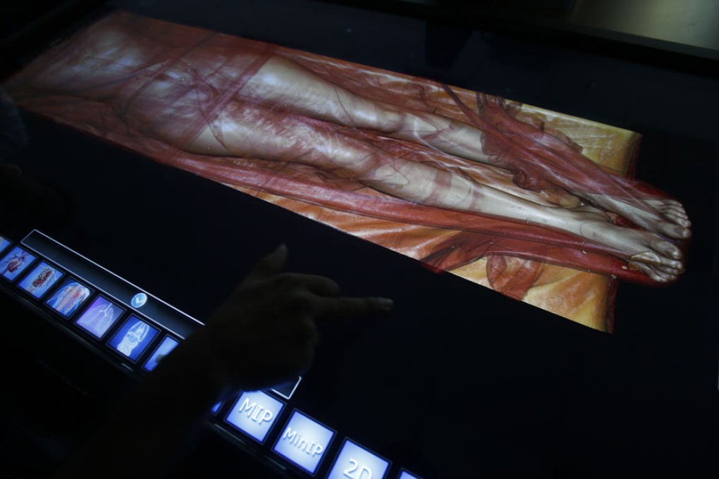 The digital autopsy forensic application. Photo: Reuters