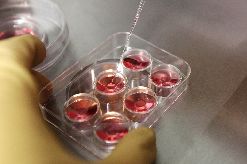 An employee extracts eggs in a lab at the e-Stork Reproductive Centre in Hsinchu. Photo: Reuters