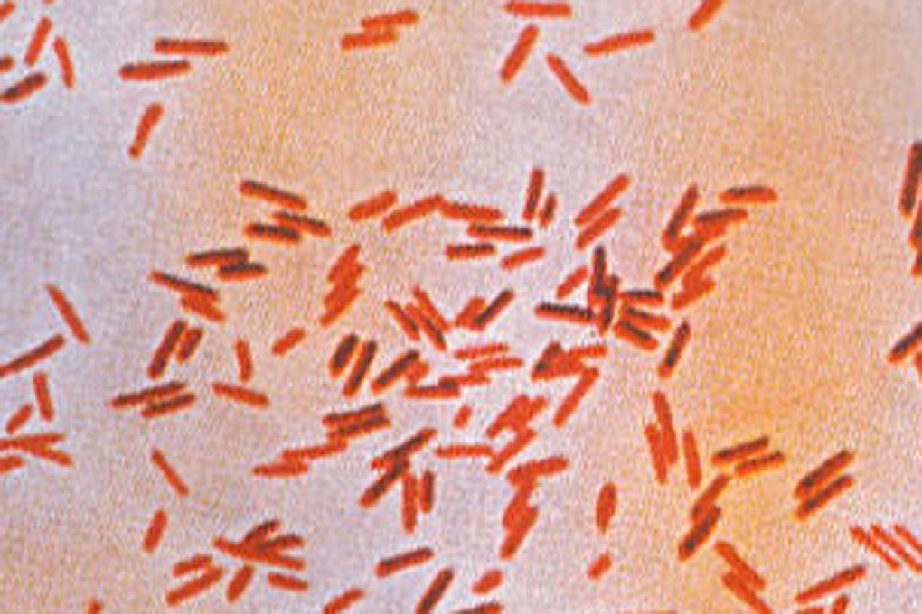 Almonella typhi, the agent of typhoid. Photo: SCMP Pictures