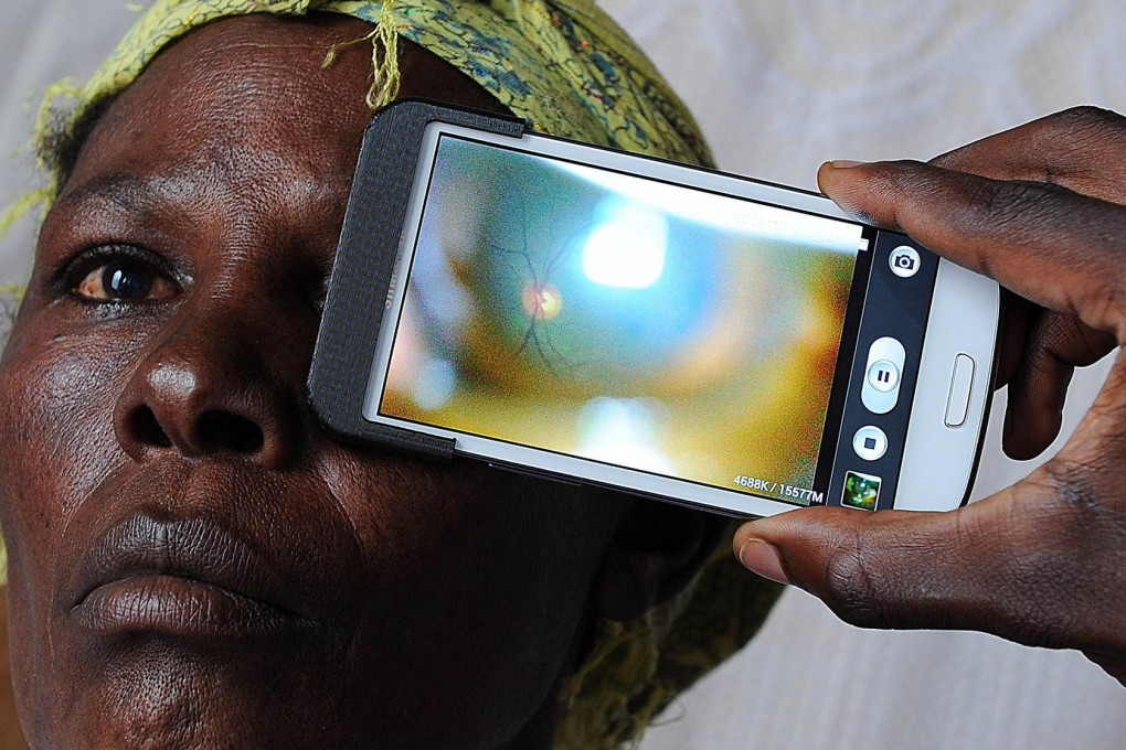 A technician uses the "Eye-Phone" to scan the eye of a woman in Kianjokoma village, near Kenya's lakeside town of Naivasha. Photo: AFP
