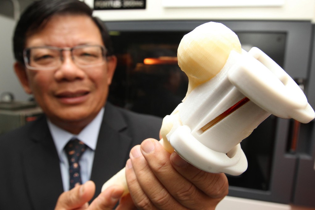 A skull implant made through use of 3-D printing. Photo: Dickson Lee