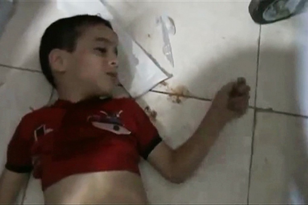 This image from video released by a U.S. government official and shown to senators shows a child apparently suffering from continuous, uncontrolled limb movement consistent with nerve agent exposure in Ain Tarma, a suburb of Damascus, Syria. Photo: AP