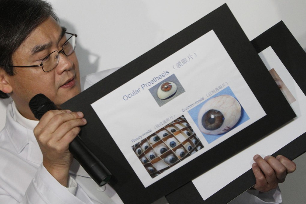 Surgeon Dr Dennis Lam Shun-chiu explains the treatment planned for Guo Bin, the boy whose eyes were gouged out on the mainland. The six-year-old and his family flew to Shenzhen from Shanxi for the operation. Guo Bin will receive implants to improve his appearance, and later have navigation aids fitted that will help him to get around. Photo: David Wong