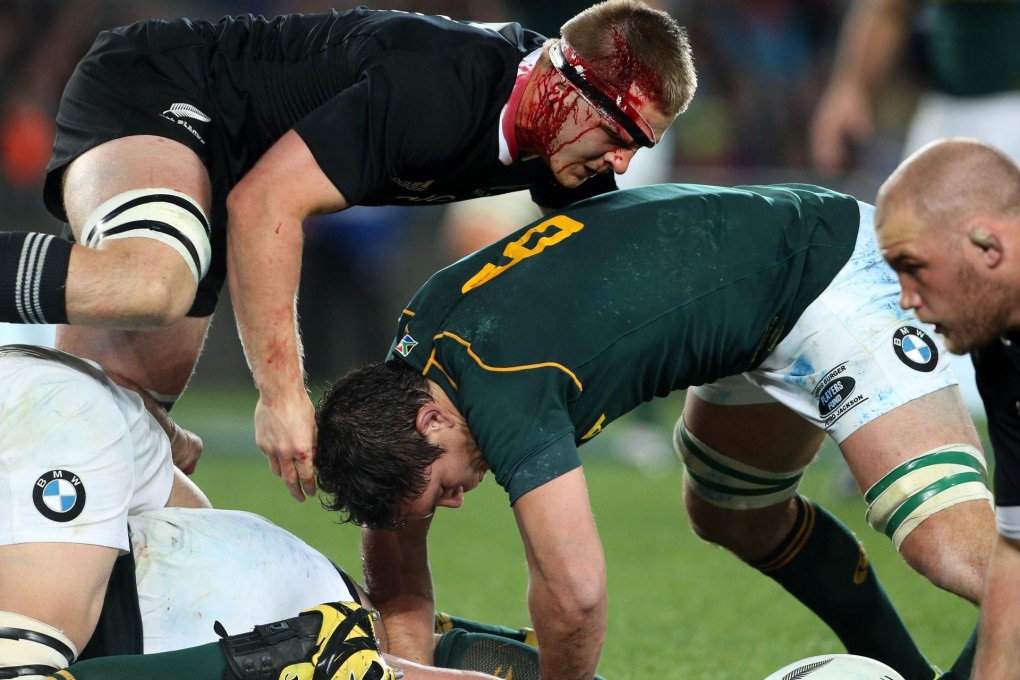 A bloodied Sam Cane of New Zealand competes with Francis Louw of South Africa at a ruck during the Auckland test. Photo: AFP