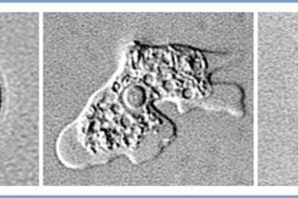 Microscopic images show theNaegleria fowleri amoeba in different forms of existence: a cyst stage (left), trophozoite stage (centre) and full-size "flagellated" stage. Photo: AP