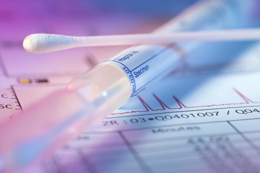 DNA tests lead to early discovery of Sudden Arrhythmia Death Syndrome