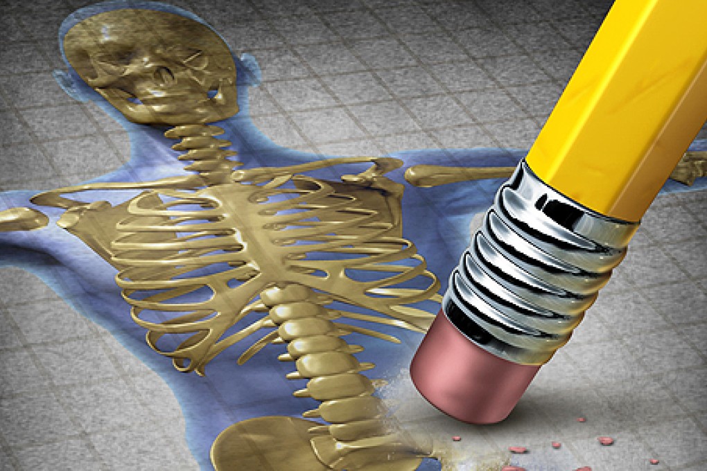 Diet and lifestyle changes key to protecting women against osteoporosis