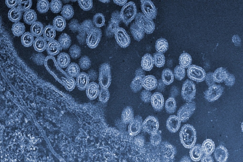 Infectious particles of the avian H7N9 virus emerging from a cell. Photo: AP