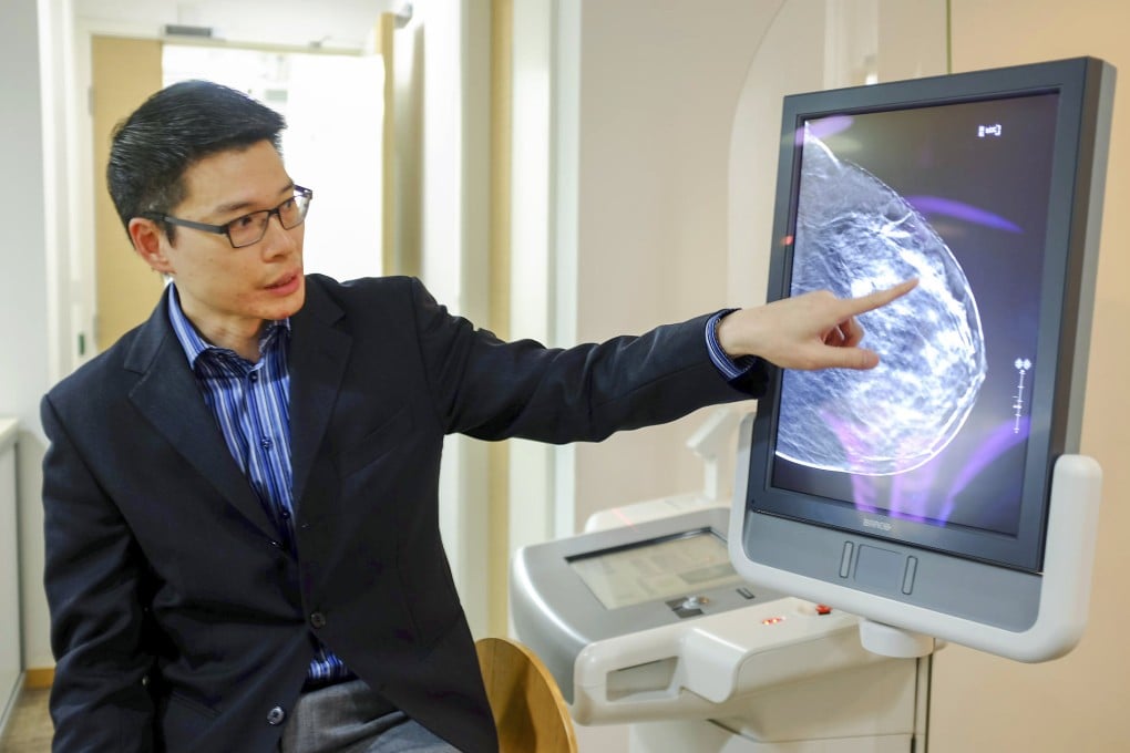 Dr Hung Wai-ka, honorary adviser to the Hong Kong Breast Cancer Foundation, shows what a 3-D image of the breast looks like. Photo: Jeanette Wang